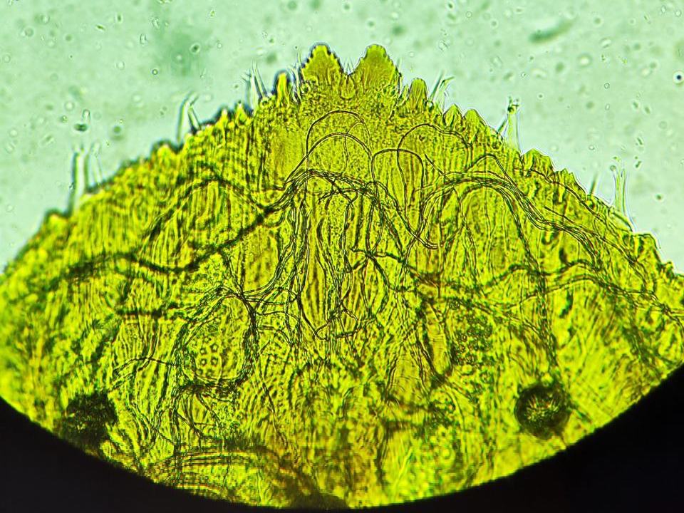 Амурским филиалом ФГБУ «НЦБРП» выявлено 19 случаев тутовой щитовки на плодах импортных киви